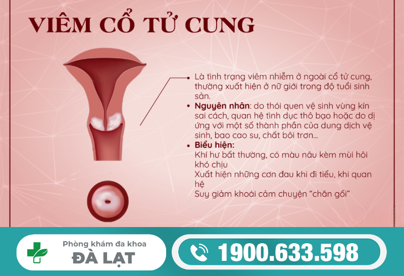 Hình ảnh minh họa